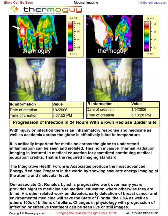 Inflammatory Response