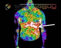 Critically Important Science Advancements Allow Sight of Temperature Using Non Invasive Radiology