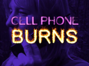 Cell Phone Burns