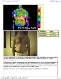 Difficult Diagnosis Of Acute Pancreatitis With Non Invasive Imaging