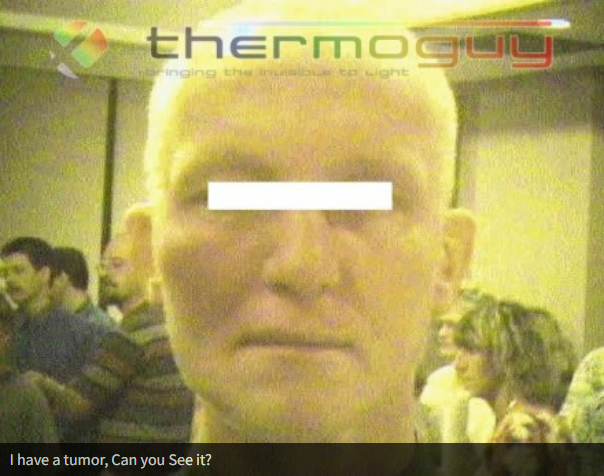 I have a tumour; Can you See it?