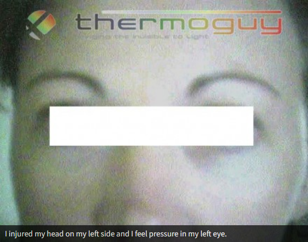 I injured my head on my left side and I feel pressure in my left eye.