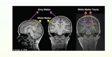 People Are NOT Sensitive to Their Electromagnetic Radiation From Wireless-3