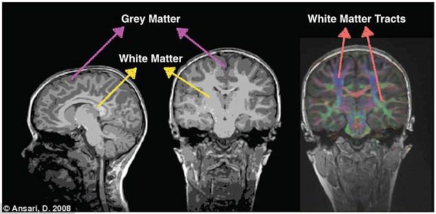  image provided through media of the brain