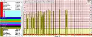 Cardiac Event Report