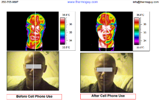 Cell Phone Radiation